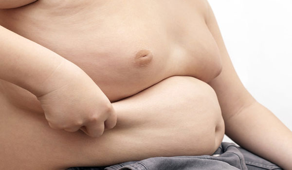 Παχυσαρκία και Covid-19 ένας επικίνδυνος συνδυασμός.